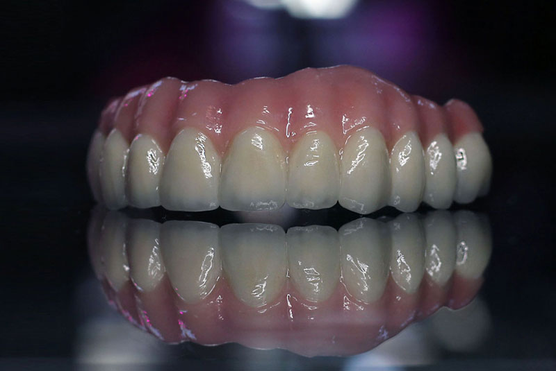 zirconia fixed bridge on counter